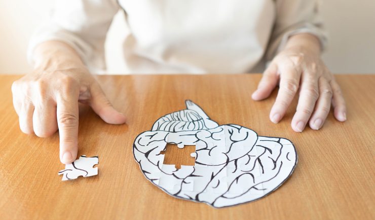 Alzheimer